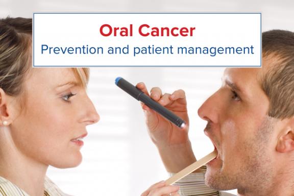 FDI_Oral cancer