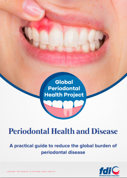 Periodontal health and disease_A practical guide to reduce the global burden of periodontal disease_toolkit